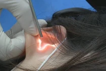 Bạn trai làm điều này khi ân ái, cô gái cầu cứu bác sĩ