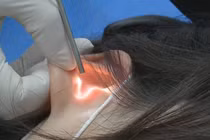 Bạn trai làm điều này khi ân ái, cô gái cầu cứu bác sĩ