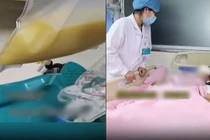 Bé gái 13 tuổi khiến bác sĩ sợ tái mặt vì điều này