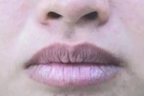 Phổi hư, cơ thể hiện rõ 3 dấu hiệu này 