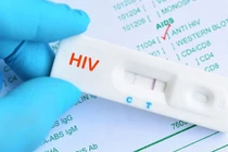 Tưởng nhiễm HIV suy sụp suýt chết, 5 năm sau biết xét nghiệm nhầm
