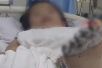 Bé gái nguy cơ cắt cụt chi vì dùng điện thoại kiểu này 