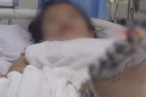 Bé gái nguy cơ cắt cụt chi vì dùng điện thoại kiểu này 