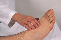 Chân xuất hiện 2 dấu hiệu này, đi khám ngay kẻo tắc mạch máu