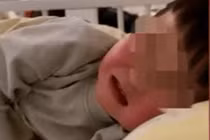 Ăn cam rồi uống nước này, bé trai lồng ruột suýt chết