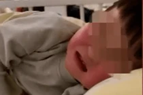 Ăn cam rồi uống nước này, bé trai lồng ruột suýt chết