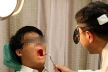 Ung thư miệng cực thích 4 kiểu người này, bạn có trong số đó?