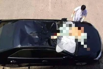 Nam bệnh nhân nhảy lầu tự tử rơi trúng nóc ô tô