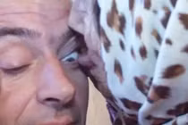 Rùng mình kiểu chữa bệnh lạ hoắc... bằng lưỡi của cụ bà