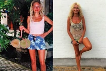 Khủng khiếp cô gái không ăn gì ngoài trái cây suốt 27 năm