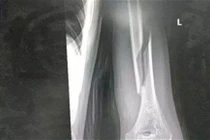 Mất ngủ, cha và con bày trò lạ, gặp chuyện kinh dị 