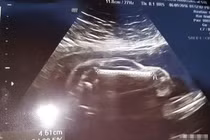 Chồng mê xe hơi, đưa vợ đi siêu âm, phát hiện điều choáng váng...