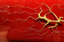 Nhân sâm vua "Quang Minh Chính Đại" gần 6 tỷ đồng có gì đặc biệt?