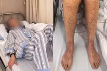 Cô gái bị bệnh cực đáng sợ, phục hồi như phép màu gây choáng