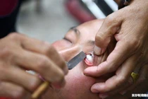 Chuyện lạ hôm nay: Người đàn ông dùng dao rửa mắt và kết khó tin