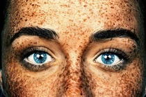 Chân dung đẹp "rùng mình" về những cô gái chi chít tàn nhang