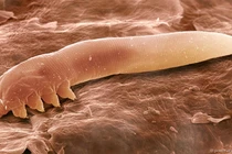 Giải mã loài rận sinh sống ở vùng kín của phụ nữ