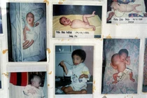 Loạt ảnh kinh hoàng về di chứng của chiến tranh Việt Nam (2)