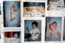 Loạt ảnh kinh hoàng về di chứng của chiến tranh Việt Nam (2)