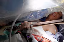 Bệnh nhân chơi đàn khi đang mổ u não