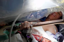 Bệnh nhân chơi đàn khi đang mổ u não