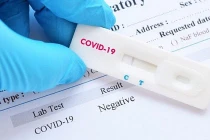 Hà Nội: 3 trường hợp dương tính test nhanh không mắc COVID-19