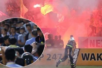 CĐV Nam Định bắn pháo sáng trúng fan nữ, CLB Hà Nội thất thu tiền khủng bao nhiêu? 