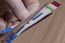 Bệnh viện Xanh Pôn chẻ đôi que thử HIV: Tăng thanh tra hoạt động xét nghiệm