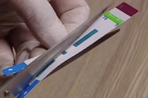 Bệnh viện Xanh Pôn chẻ đôi que thử HIV: Tăng thanh tra hoạt động xét nghiệm