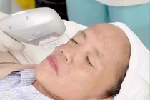 Bà Tân Vlog lộ mặt đơ cứng không nhận ra