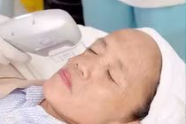 Bà Tân Vlog lộ mặt đơ cứng không nhận ra