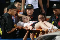 Fan nữ trúng pháo sáng CĐV Nam Định: VFF có “động thái” gì?