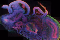 "Rúng động" các nhà khoa học tạo phôi não người