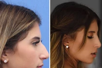 Làm giàu nhờ… từ bỏ khuôn mặt cha sinh mẹ đẻ