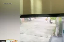 Bé trai khâu hơn 200 mũi vì bị chó dữ tấn công