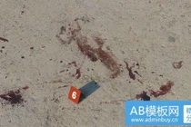 Nữ nhân viên quán ăn bị cứa cổ trong đêm