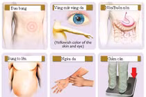 Ngứa liên tục có thể là dấu hiệu của căn bệnh ung thư có tỷ lệ mắc mới nhiều nhất tại Việt Nam