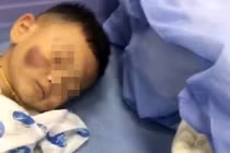 Bé 2 tuổi bị mẹ kế đánh đến tụ máu não, cha ruột giấu giếm