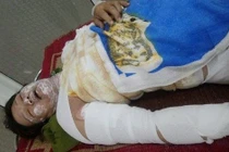 Vợ bị tẩm xăng đốt vì cãi chồng khi đang say rượu