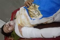 Vợ bị tẩm xăng đốt vì cãi chồng khi đang say rượu