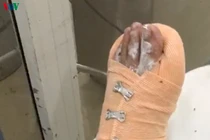 Giải cứu cô gái bị người tình hành hạ dã man tại Tây Ninh