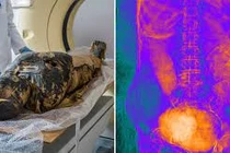 Kiểm tra hộp sọ xác ướp mang thai, lộ bí mật cực sốc