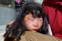 Bị đánh trên đường đi học về, nữ sinh lớp 6 nói gì?