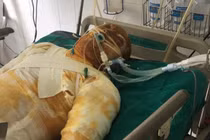 Kẻ tưới xăng “thiêu sống” đồng nghiệp cũ bị khởi tố về tội “Giết người”