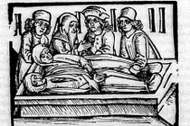 Căn bệnh bí ẩn bùng phát ở Anh khiến hàng nghìn người chết