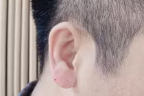 Lạ lùng trào lưu đàn ông đua nhau đi tiêm tai “Phật Di Lặc“