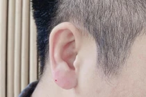 Lạ lùng trào lưu đàn ông đua nhau đi tiêm tai “Phật Di Lặc“