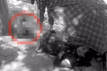 Người phụ nữ gãy gập cổ chân vì áo chống nắng cuốn vào bánh xe Grab