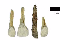 Khai quật mộ cổ, phát hiện sốc cách người xưa chăm sóc, làm đẹp răng