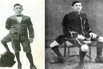 Sự thật ngỡ ngàng "dị nhân" 3 chân nổi tiếng nhất lịch sử